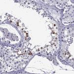 POM121L12 Antibody in Immunohistochemistry (IHC)