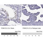POM121L12 Antibody