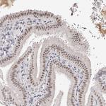 APC11 Antibody in Immunohistochemistry (IHC)