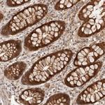 HEXDC Polyclonal Antibody