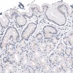 DMRT1 Antibody in Immunohistochemistry (Paraffin) (IHC (P))
