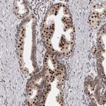 THUMPD1 Antibody in Immunohistochemistry (Paraffin) (IHC (P))