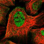 UBR2 Polyclonal Antibody