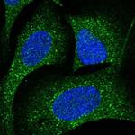 CDK5RAP3 Polyclonal Antibody