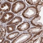 NAV1 Polyclonal Antibody