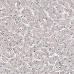 DOPEY1 Antibody in Immunohistochemistry (Paraffin) (IHC (P))