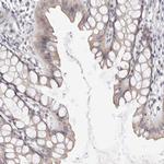 DOPEY1 Antibody in Immunohistochemistry (Paraffin) (IHC (P))