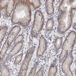 DOPEY1 Antibody in Immunohistochemistry (Paraffin) (IHC (P))