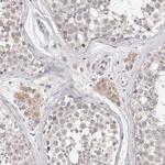 DOPEY1 Antibody in Immunohistochemistry (Paraffin) (IHC (P))