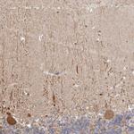 DOPEY1 Antibody in Immunohistochemistry (IHC)