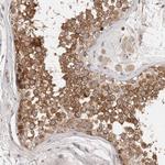 DOPEY1 Polyclonal Antibody