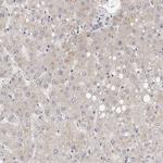 DOPEY1 Antibody in Immunohistochemistry (IHC)