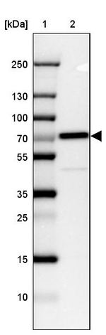 CTNNBL1 Antibody in Western Blot (WB)