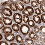 TBC1D22B Polyclonal Antibody