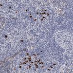 TBC1D22B Polyclonal Antibody