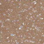 HINT3 Antibody in Immunohistochemistry (Paraffin) (IHC (P))