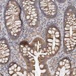 HINT3 Antibody in Immunohistochemistry (Paraffin) (IHC (P))