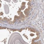 HINT3 Antibody in Immunohistochemistry (Paraffin) (IHC (P))