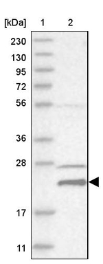 HINT3 Antibody in Western Blot (WB)