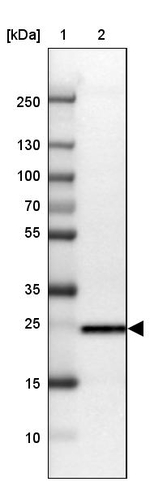 TPD52L1 Antibody in Western Blot (WB)