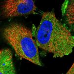 TPD52L1 Polyclonal Antibody