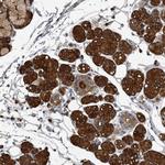 TPD52L1 Antibody in Immunohistochemistry (Paraffin) (IHC (P))