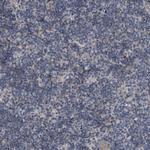 TPD52L1 Antibody in Immunohistochemistry (IHC)