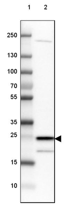 TPD52L1 Antibody in Western Blot (WB)