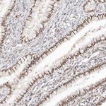 LARP7 Antibody in Immunohistochemistry (Paraffin) (IHC (P))