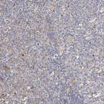 MSRB2 Polyclonal Antibody