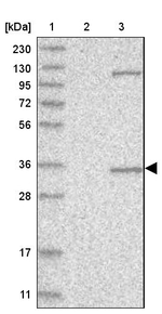 AIDA Antibody in Western Blot (WB)