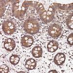 PANK4 Antibody in Immunohistochemistry (Paraffin) (IHC (P))