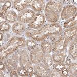 PANK4 Antibody in Immunohistochemistry (Paraffin) (IHC (P))