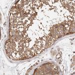 PANK4 Polyclonal Antibody