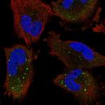 UNK Antibody in Immunocytochemistry (ICC/IF)