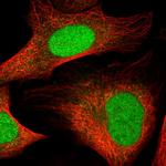 HMGN3 Antibody in Immunocytochemistry (ICC/IF)