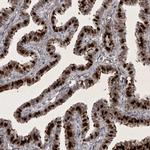 HMGN3 Antibody in Immunohistochemistry (IHC)