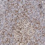 HMGN3 Antibody in Immunohistochemistry (IHC)