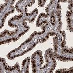 HMGN3 Antibody in Immunohistochemistry (IHC)