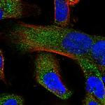 ZCCHC11 Polyclonal Antibody