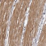 ZCCHC11 Antibody in Immunohistochemistry (Paraffin) (IHC (P))