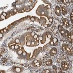 ALPK2 Antibody in Immunohistochemistry (Paraffin) (IHC (P))