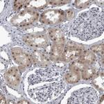 RTCA Antibody in Immunohistochemistry (IHC)