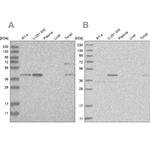RTCA Antibody in Western Blot (WB)