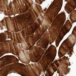 C8orf74 Polyclonal Antibody