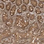 TIPRL Antibody in Immunohistochemistry (IHC)