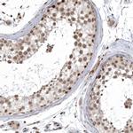 ISG20L2 Antibody in Immunohistochemistry (IHC)