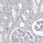 DTL Antibody in Immunohistochemistry (Paraffin) (IHC (P))