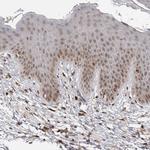 DTL Antibody in Immunohistochemistry (Paraffin) (IHC (P))