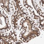 CCDC18 Antibody in Immunohistochemistry (Paraffin) (IHC (P))